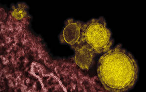 Micrografía electrónica de transmisión de partículas de coronavirus del síndrome respiratorio de Oriente Medio, coloreadas en amarillo